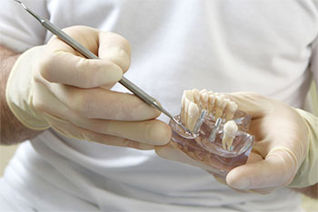 Zahnarzt mit Zahnimplantat - Dr. Weitze Implantologie Hamburg