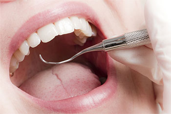Bild geöffneter Mund, Zahnarzt-Instrument - Untersuchungsmethoden in der Parodontologie