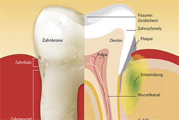 Bild von Zahn-Querschnitt - Dr. Weitze, Zahnarzt und Parodontologie Hamburg